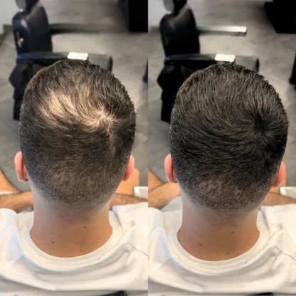 Apex Hair Offer Instant Hair Densifying Powder