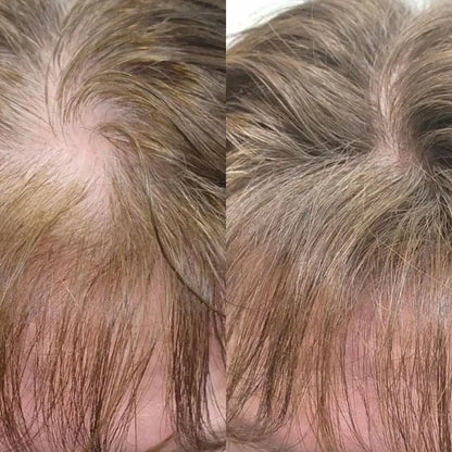 Apex Hair Woman