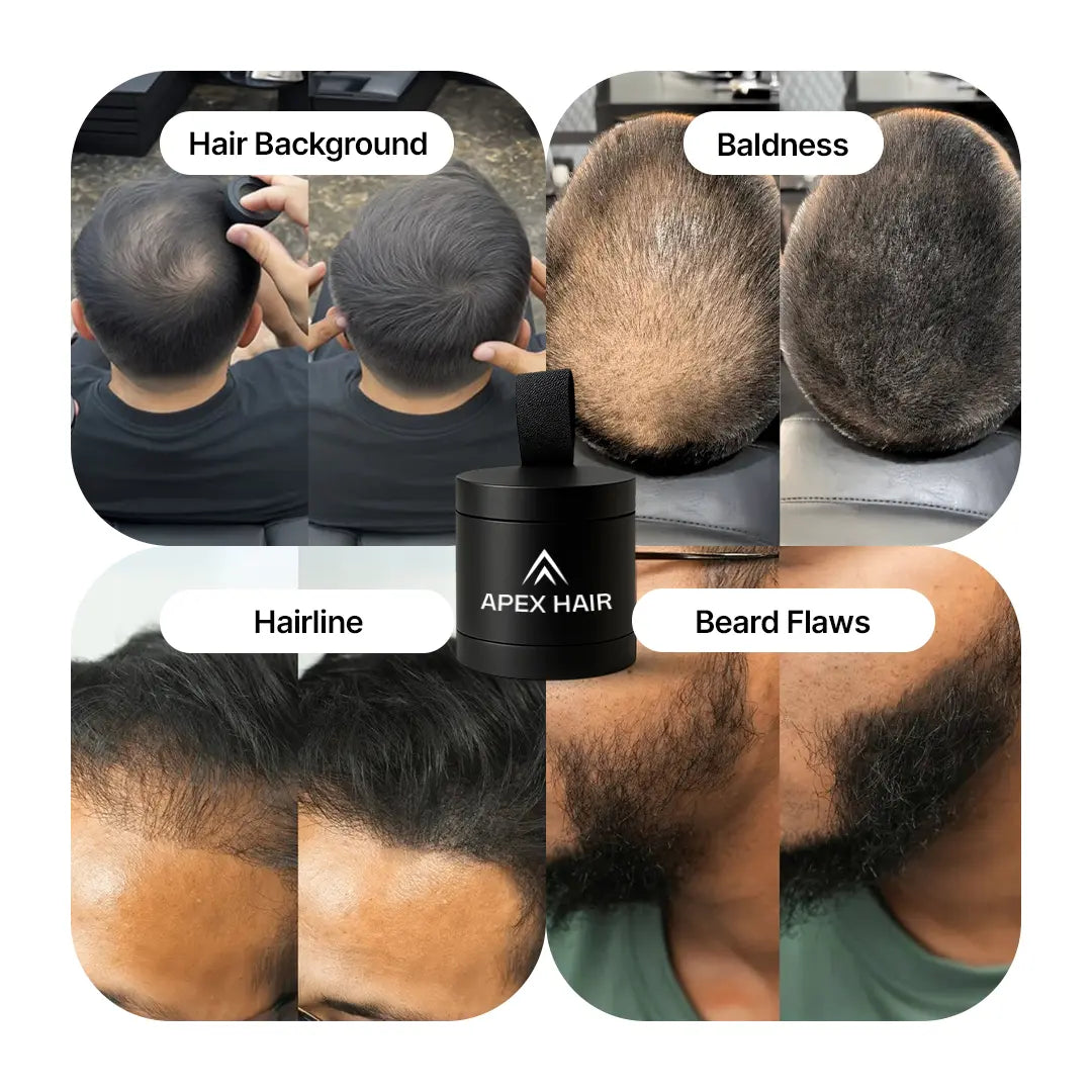 Apex Hair Offer Instant Hair Densifying Powder