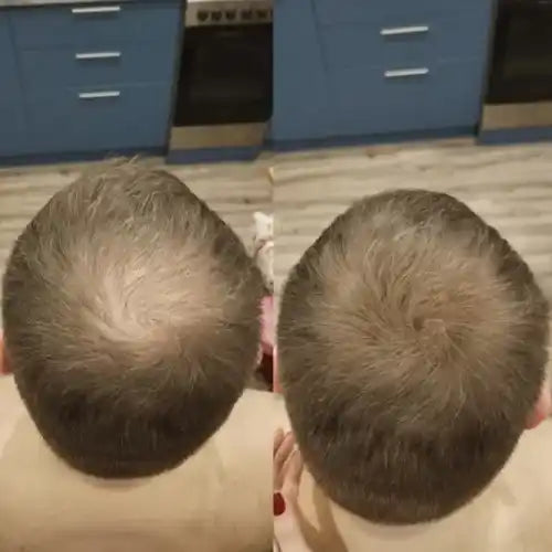 Before and after comparison of a person's hair on the back of their head.