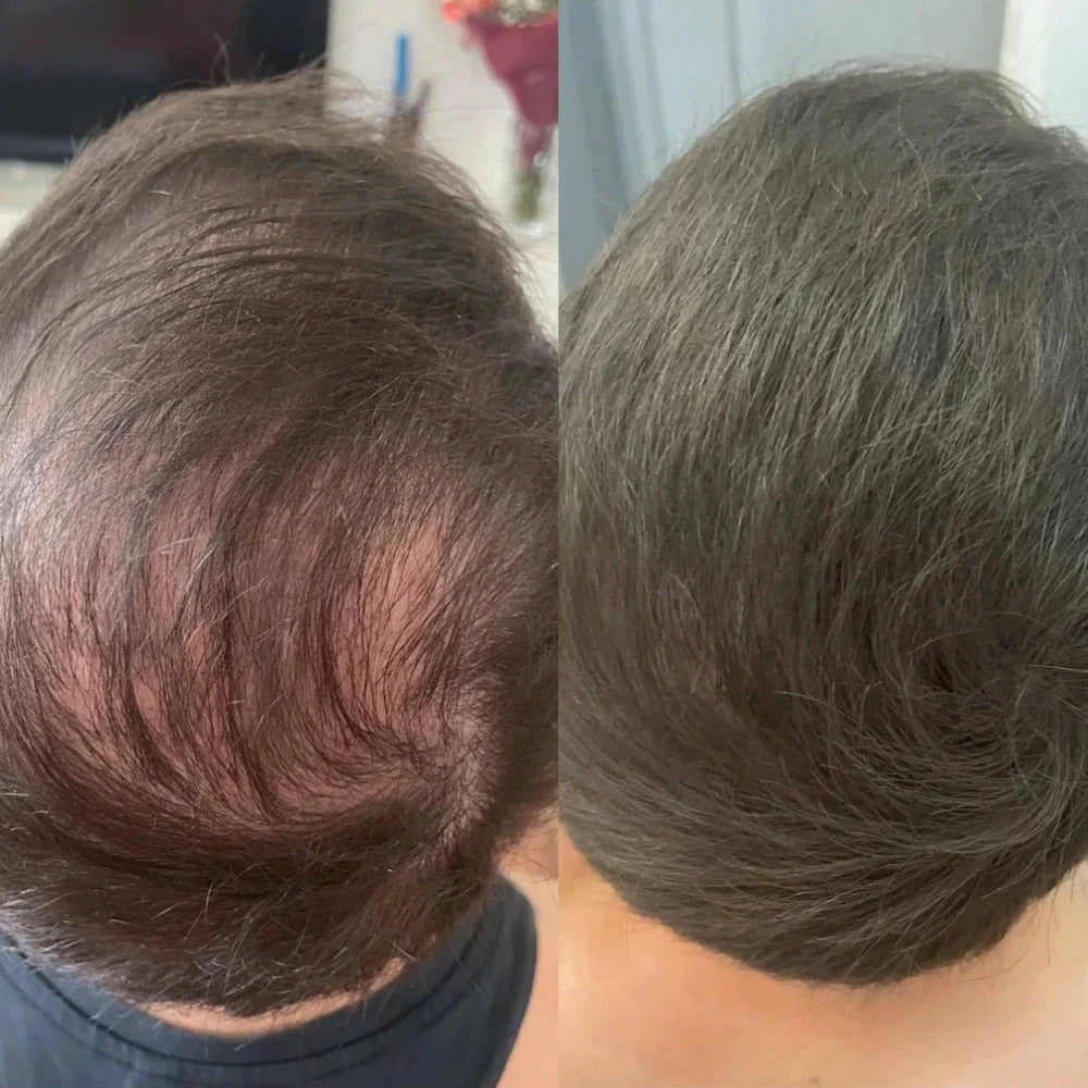 Before and after comparison of hair texture and color on a person's head.