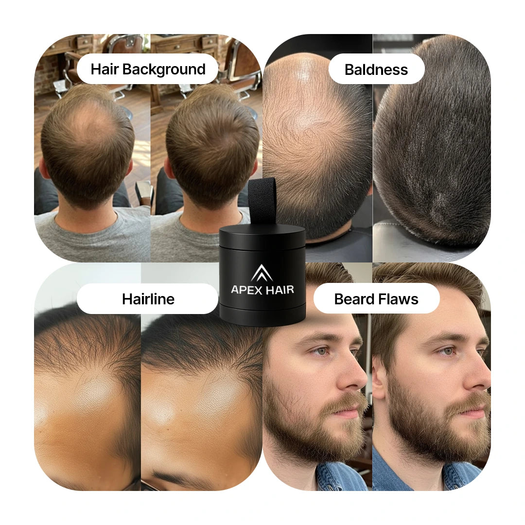 Apex Hair • Precision Density Formula